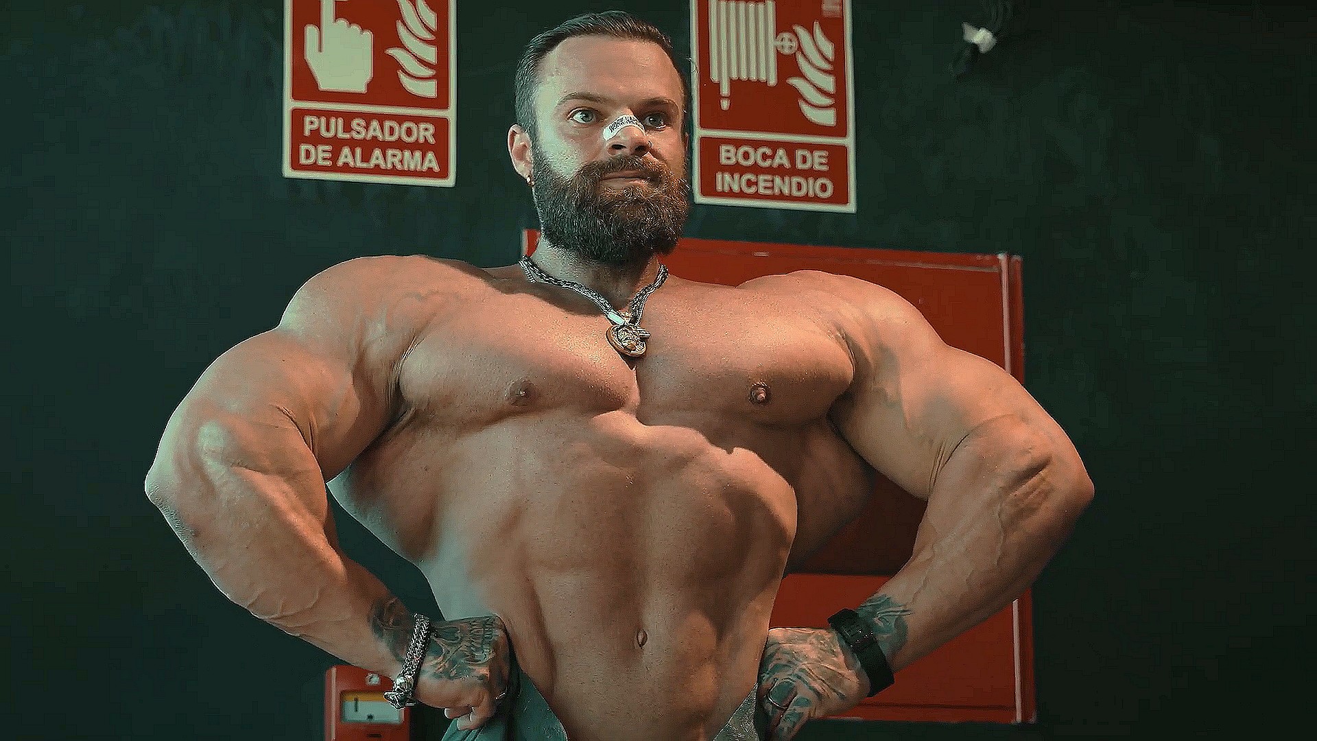 "Ложусь на операцию по удалению кисты" - Майк Зоммерфельд борется с сильной болью - Бодибилдинг форум AnabolicShops