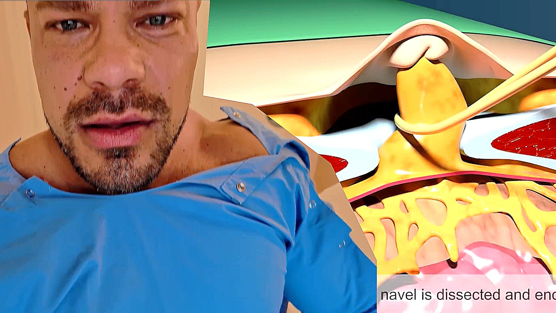 Уэсли Виссерс перенес хирургическую операцию, пропускает Олимпию - Бодибилдинг форум AnabolicShops