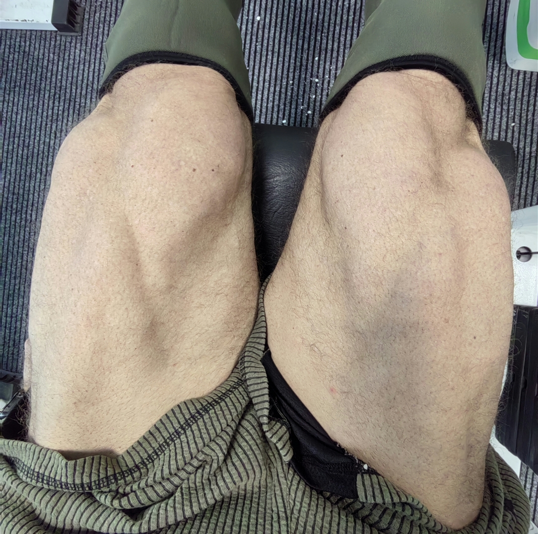 Hilma PRO - с заботой о вашем здоровье! - Бодибилдинг форум AnabolicShops