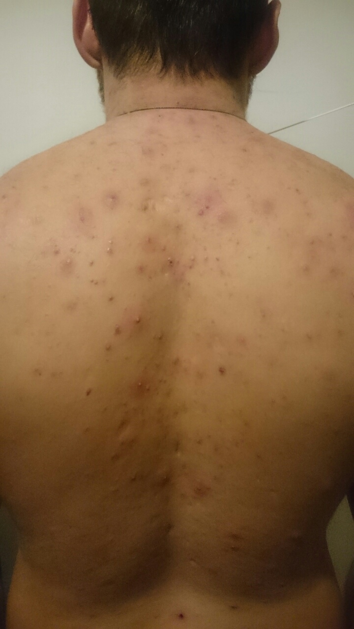 Магазин Фрэнка. Pharmacom Labs Official. Марка №1 в Мире! - Бодибилдинг форум AnabolicShops