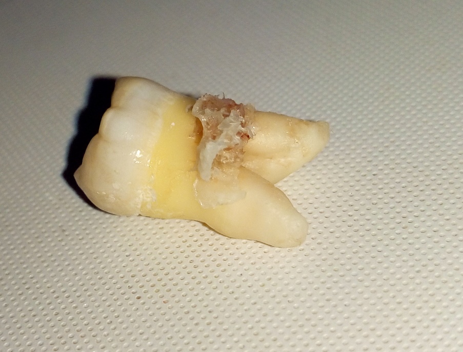 2 недели без anabolicshops - Бодибилдинг форум AnabolicShops