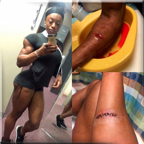 Шеник Грант стала жертвой разбойного нападения - Бодибилдинг форум AnabolicShops