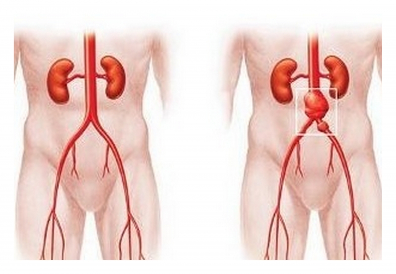 Алексей Имеряков...... - Бодибилдинг форум AnabolicShops