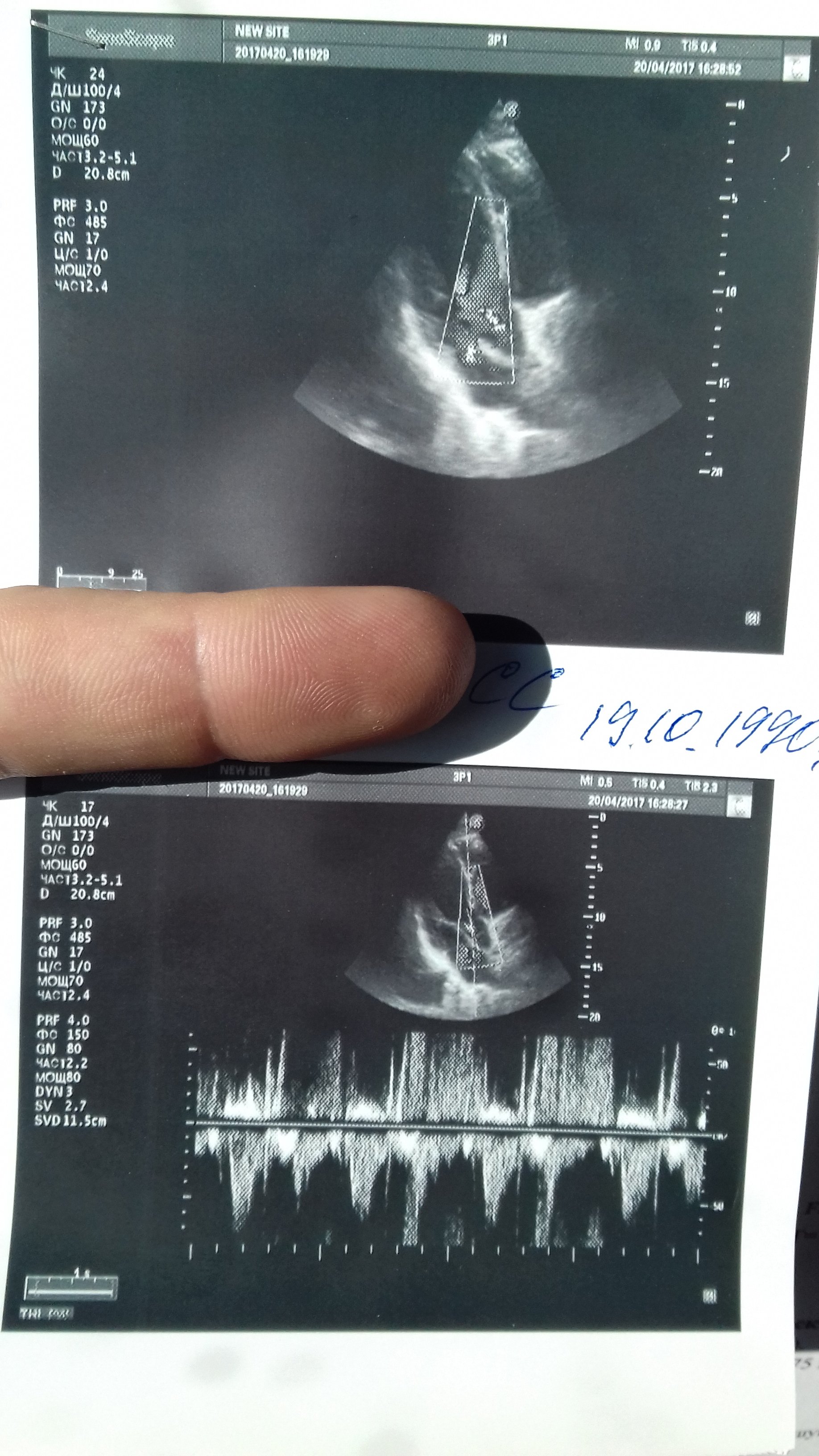 Ветка спортивного кардиолога - Бодибилдинг форум AnabolicShops