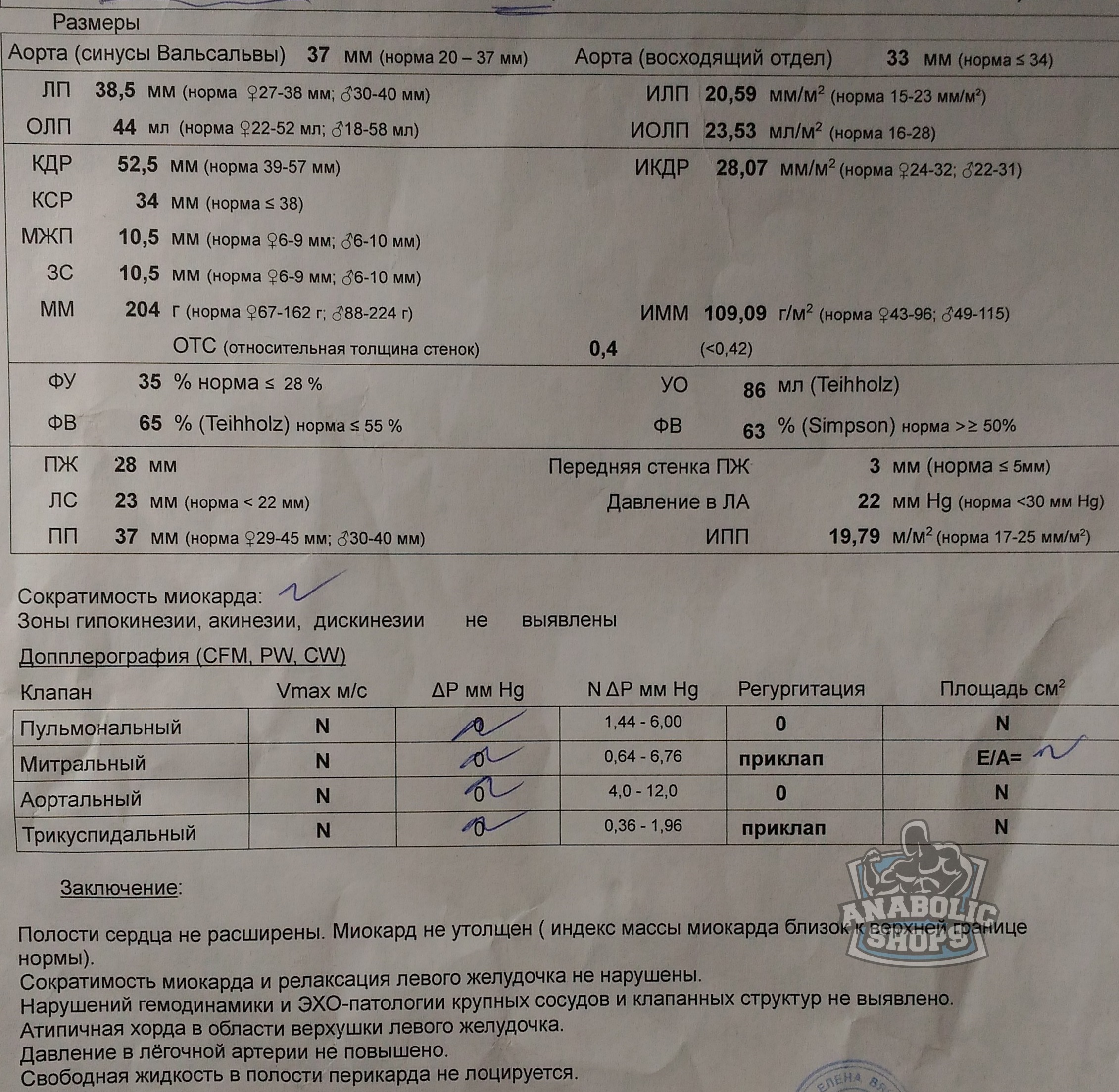 Ветка спортивного кардиолога - Бодибилдинг форум AnabolicShops