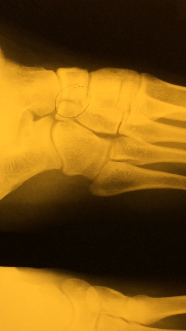 CanadaPeptides Официальный представитель. - Бодибилдинг форум AnabolicShops