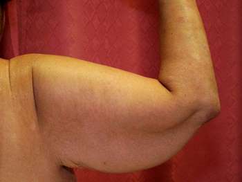 Препараты, усиливающие анаболическое действие ААС. - Бодибилдинг форум AnabolicShops