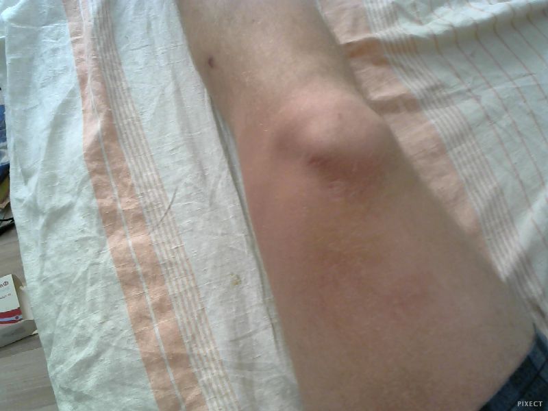 Жиросжигатели, предтренировочные комплексы - Бодибилдинг форум AnabolicShops