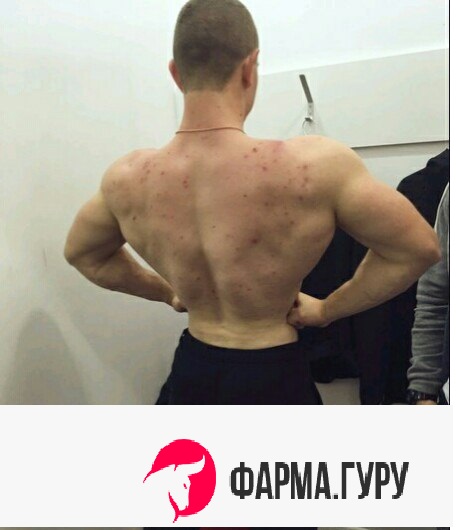 Бритиш Драгон в РФ и Украине - Бодибилдинг форум AnabolicShops