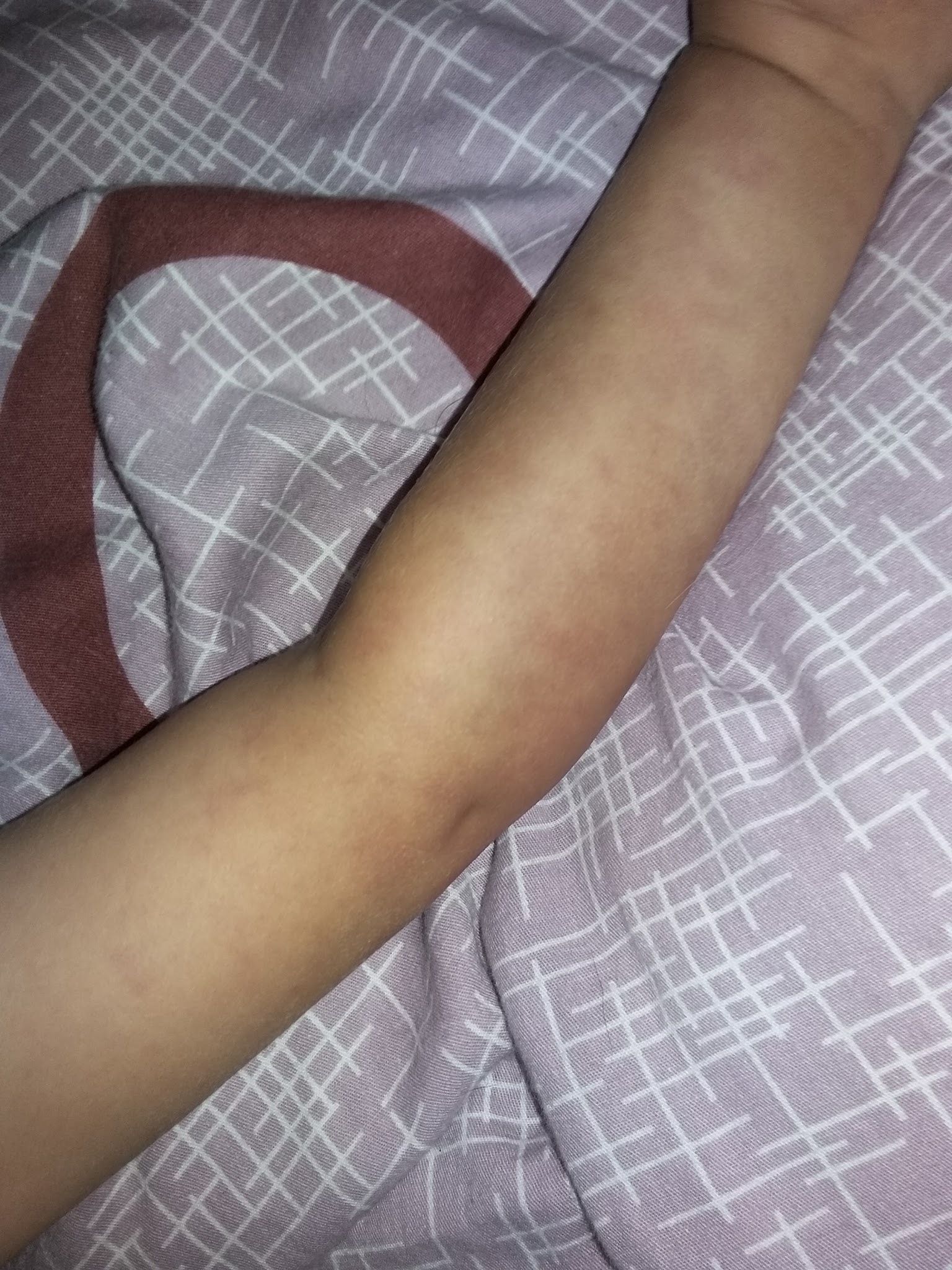 Ветка спортивного кардиолога - Бодибилдинг форум AnabolicShops