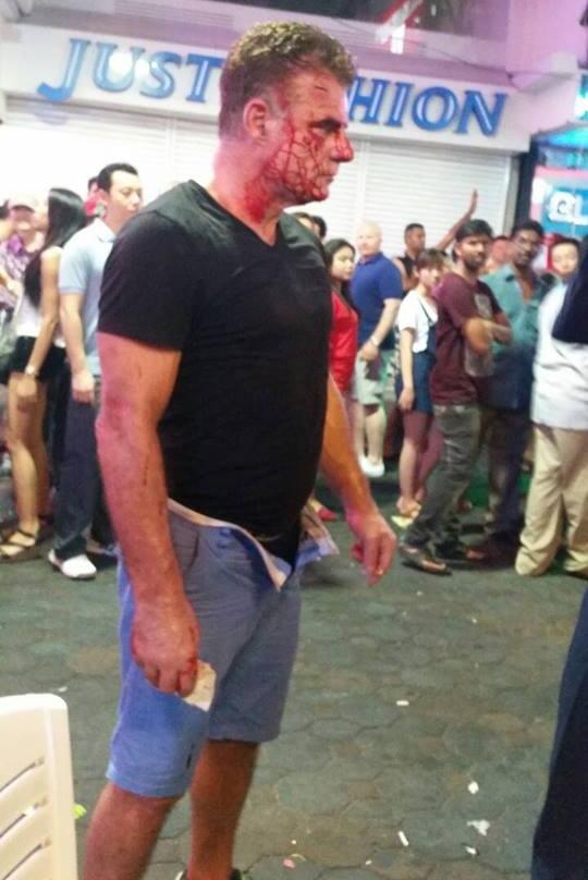 Турист получил звездюлей от тайского "леди-боя" - Бодибилдинг форум AnabolicShops