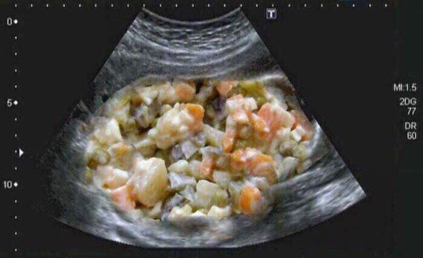 IndiaGenericPower- магазин ПКТ! - Бодибилдинг форум AnabolicShops